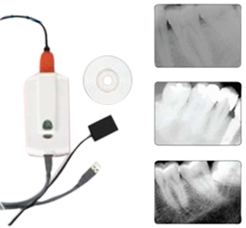 Dental Digital X-Ray Sensor